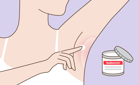 Application of Sudocrem on the armpit Card image for application of Sudocrem on the armpit