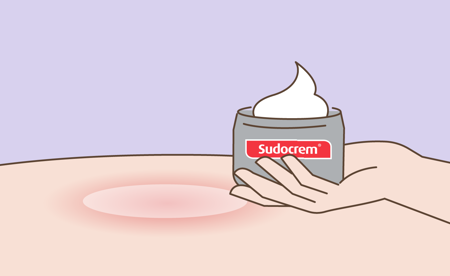 Animated version of a hand holding Sudocrem Animated version of a hand holding Sudocrem near skin
